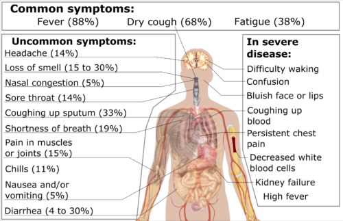 1920Px Symptoms Of Coronavirus Disease 2019 3 0