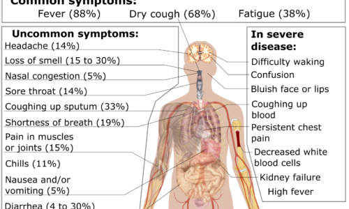 1920Px Symptoms Of Coronavirus Disease 2019 3 0